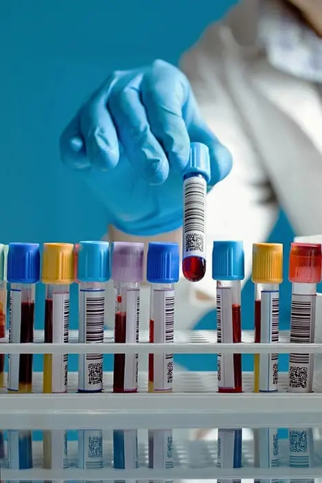 Blood Testing